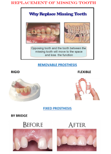 Anjali Dental Care, Ackruti, Hubtown, Mira Road East