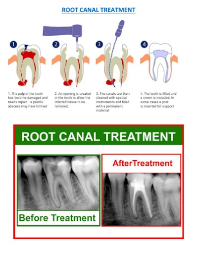 Anjali Dental Care, Ackruti, Hubtown, Mira Road East